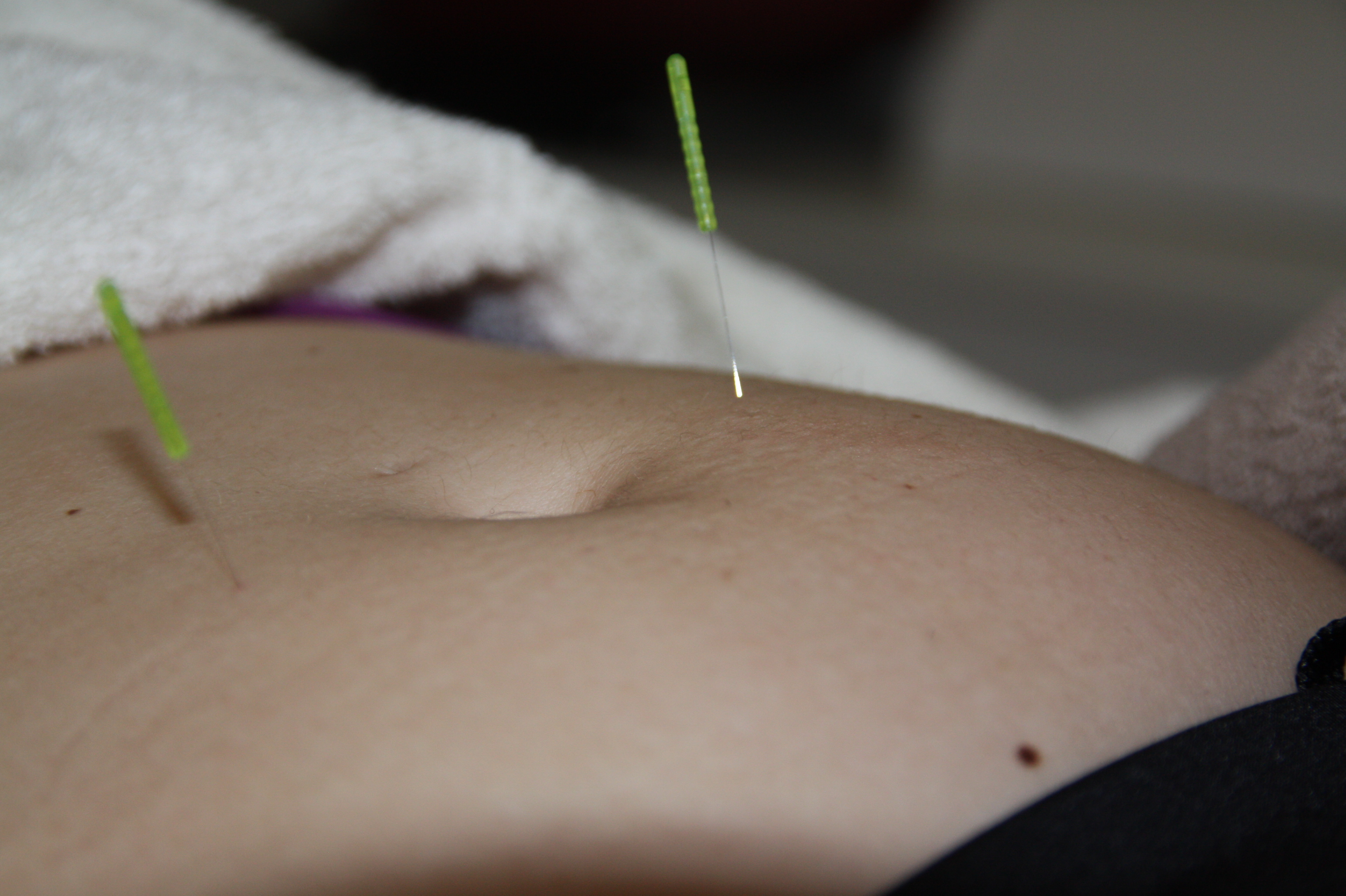 Acupunctuur praktijk An mian Oosterbeek
